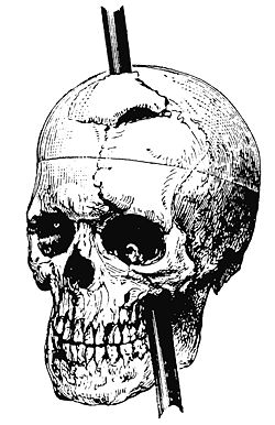 Gage skull harlow.jpg