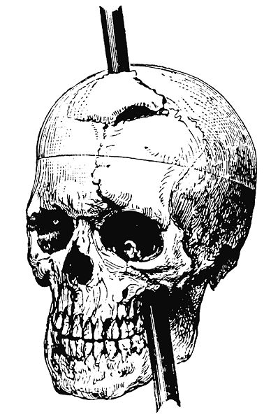 File:Gage skull harlow.jpg